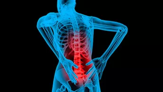 Cervical Facet Syndrome