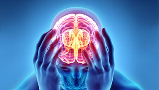 Cervicogenic Headaches
