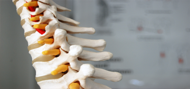 Degenerative Disc Disease (DDD)